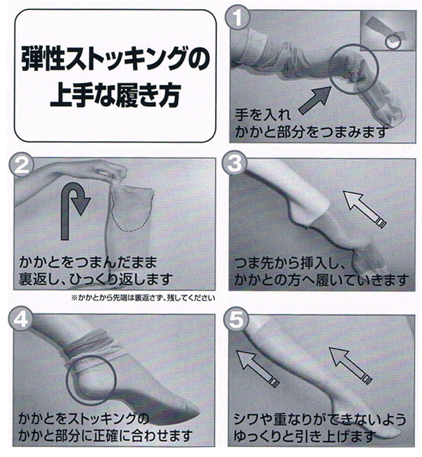 弾性ストッキング