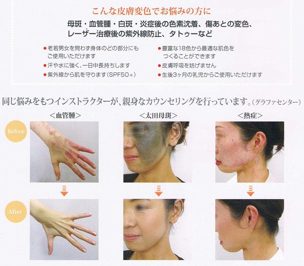 同じ悩みを持つインストラクターが、親身なカウンセリングを行っています。