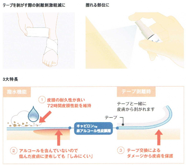 非アルコール性皮膜スプレー(未滅菌)詳細